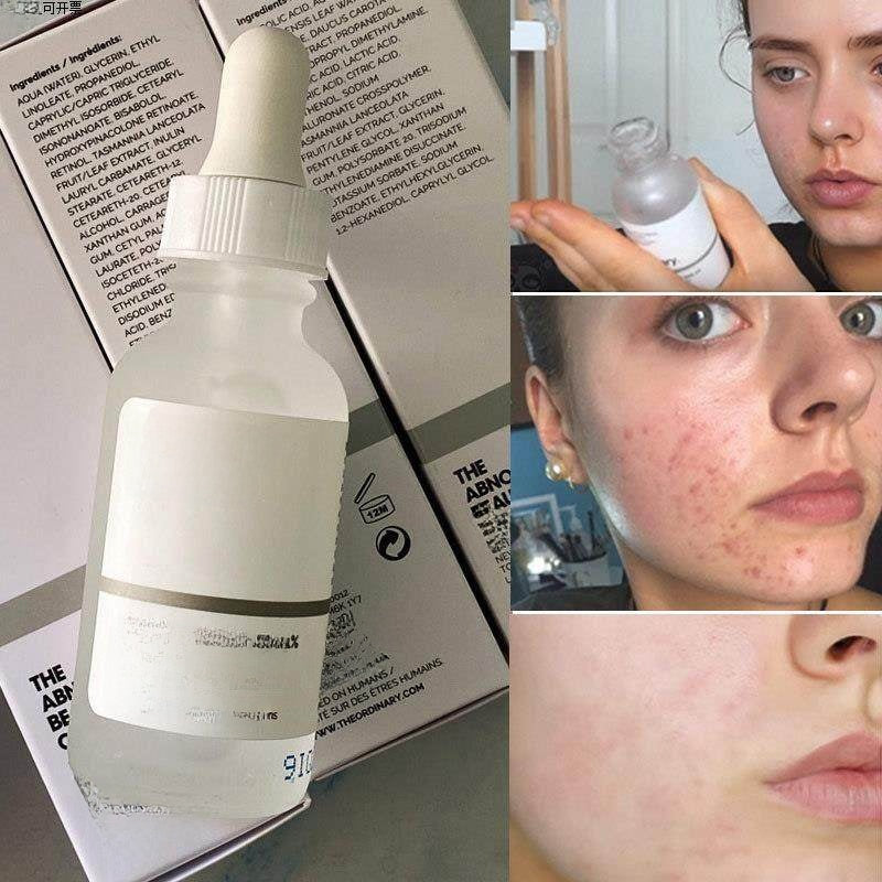 Súero Facial Multi-Activo | Facial Serum (Niacinamida, AHA, Arbutin, Cafeína)
