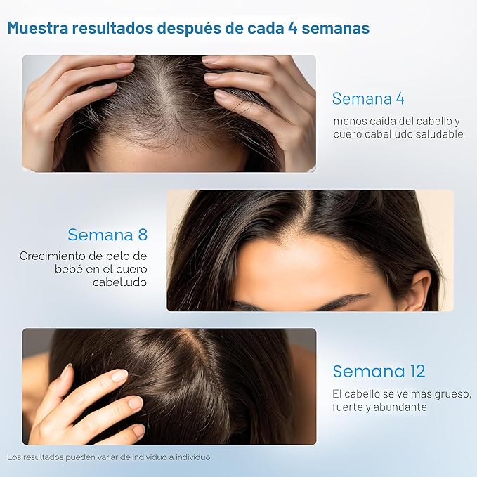 Suero de Romero para Crecimiento Capilar | 25ml