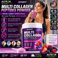 Multi Collagen Peptides Powder | Types I II III IV V | Hair, Skin, Nails & Joint Support | Berry Flavor | 28 Servings