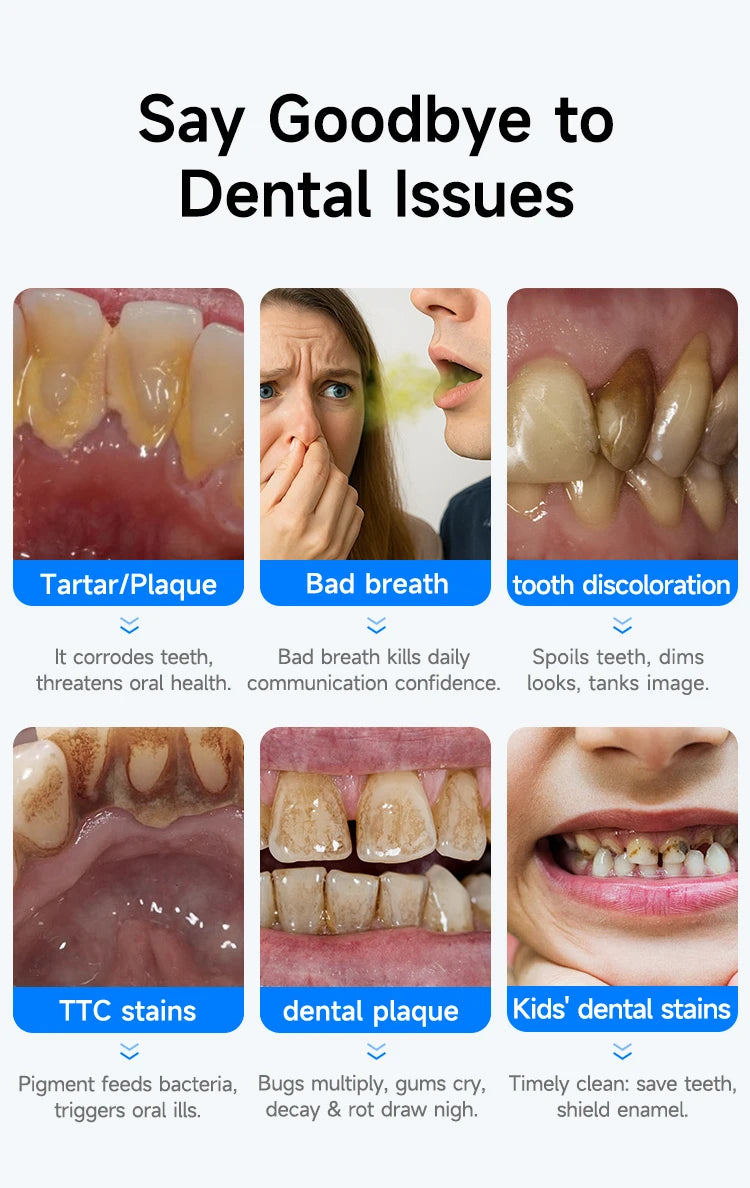 T6 Ultrasonic Dental Scaler | USB-C Oral Care Device / Escariador dental ultrasónico T6