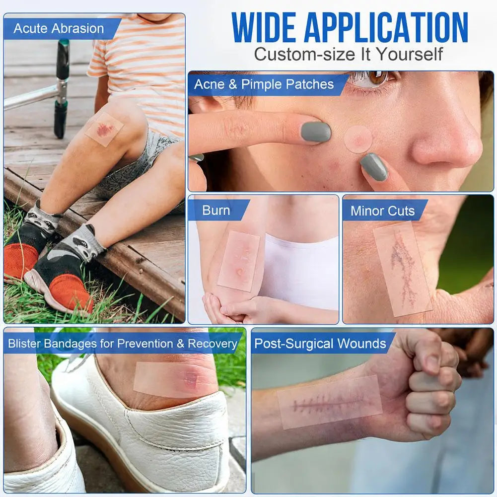 Hydrocolloid Acne Patch Roll | Cut-to-Size Blemish Cover | Rollo para Imperfecciones