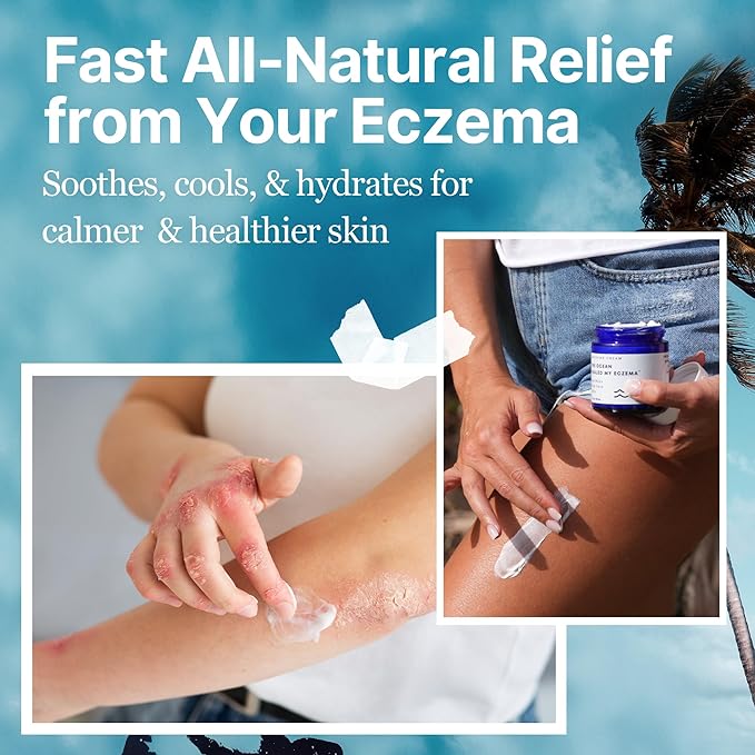 The Ocean Healed My Eczema – Crema Natural y Calmante para Eczema