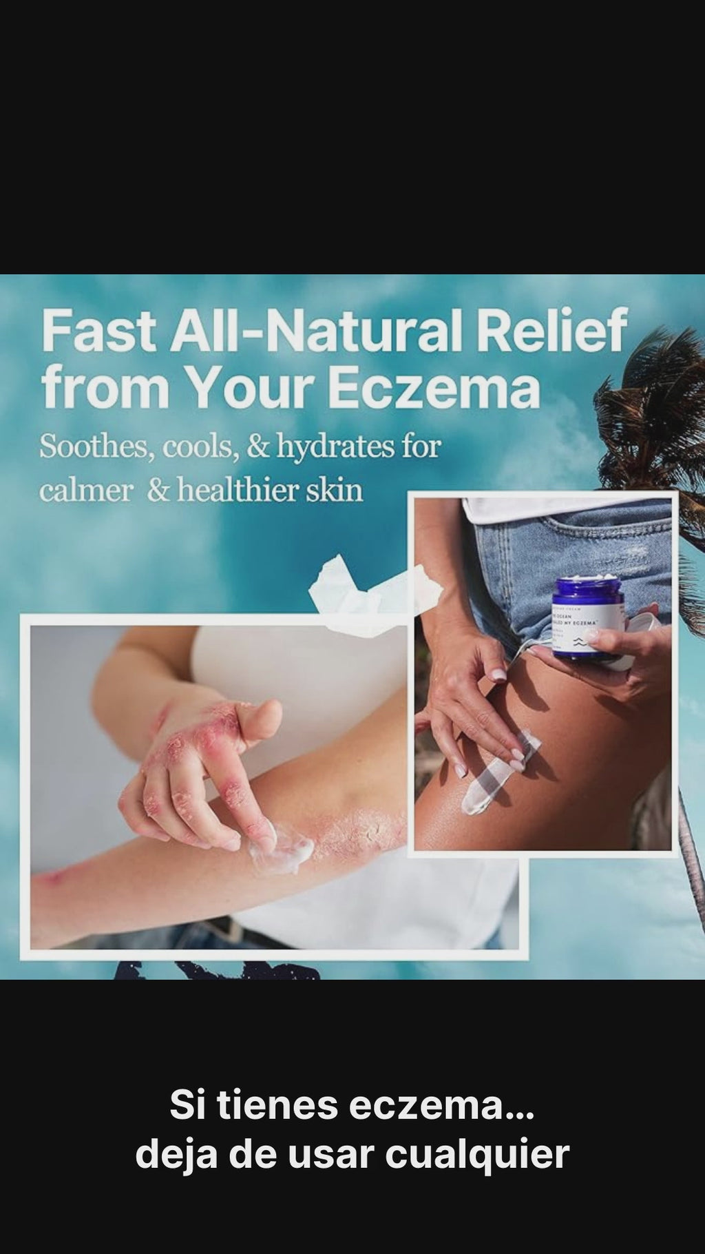 The Ocean Healed My Eczema – Crema Natural y Calmante para Eczema
